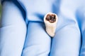 Extracted rotter molar isolated in dentistÃ¢â¬â¢s hand with blue medical glove